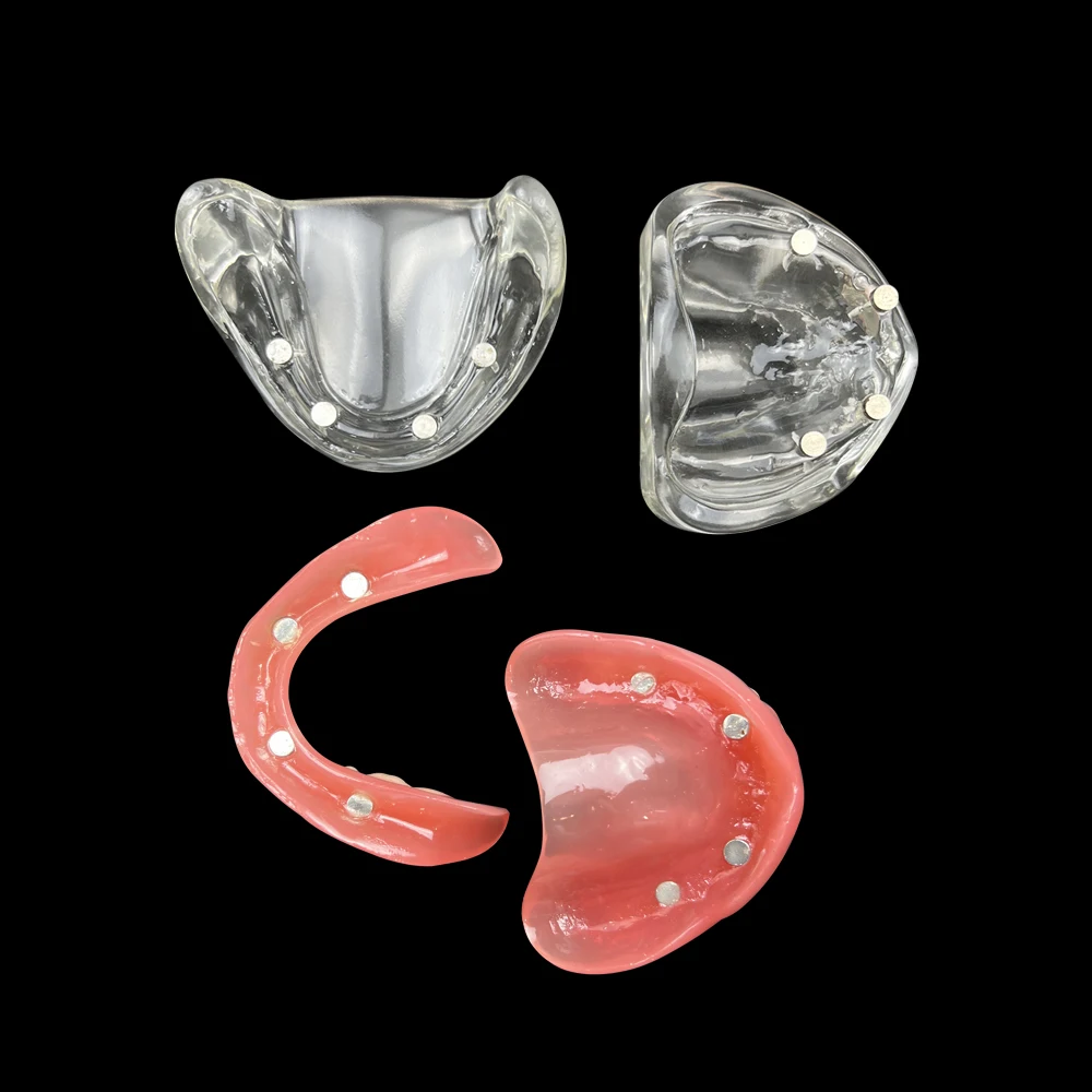 Modelo de implante Dental, producto de odontología, demostración de overdentadura Interior extraíble, mandíbula Superior e inferior con 4 implantes