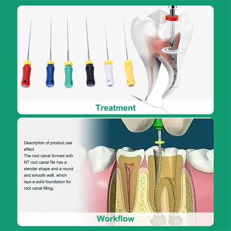 Dental R file Nickel-titanium R file expansion file 6 pieces per box of threaded root canal file oral tool consumables