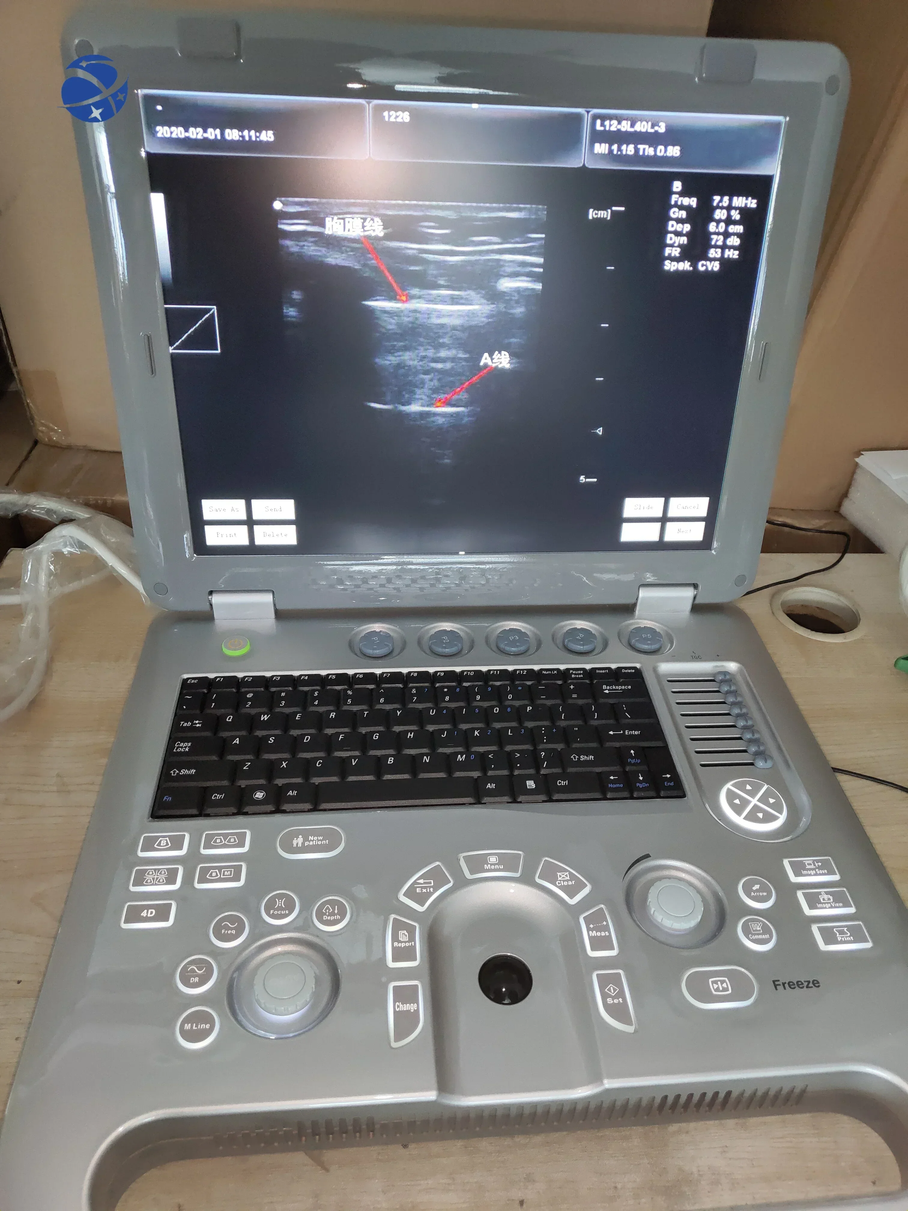 800D 902B  cheapest digital portable ecografo ultrasonido portatil Discount price laptop 3D OB GYN ultrasound machine