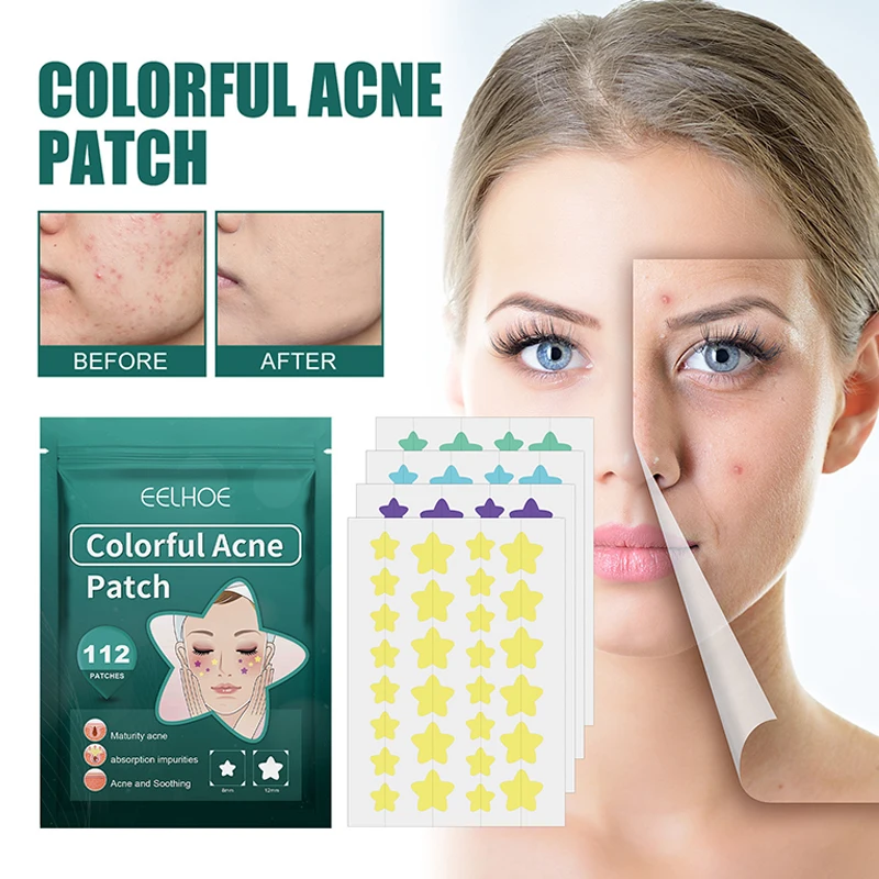 

112pcs Pimple Acne Concealer Beauty Acne Tools Star Shaped Hydrocolloid Acne Patches Cute Pimple Spot Bandages For Face Healing