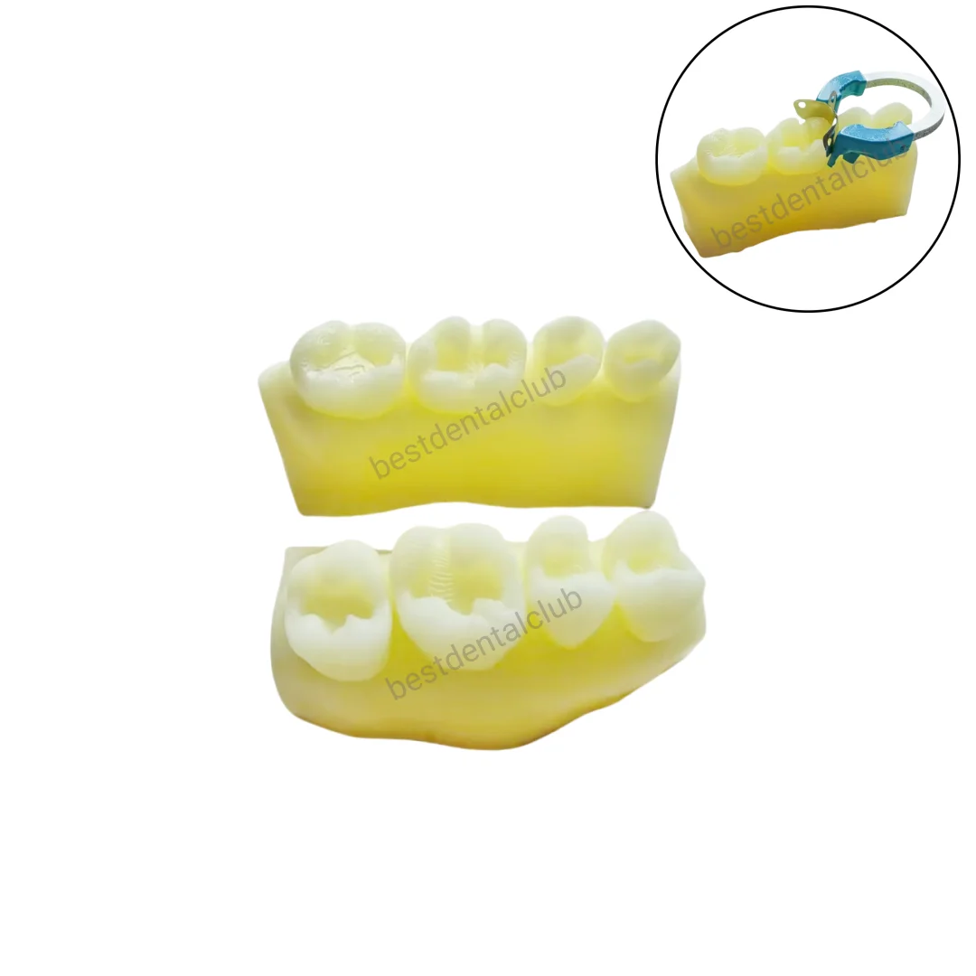 Dental Caries Model Composite Resin Restorative Simulate Class Ⅱ Aesthetic Restoration