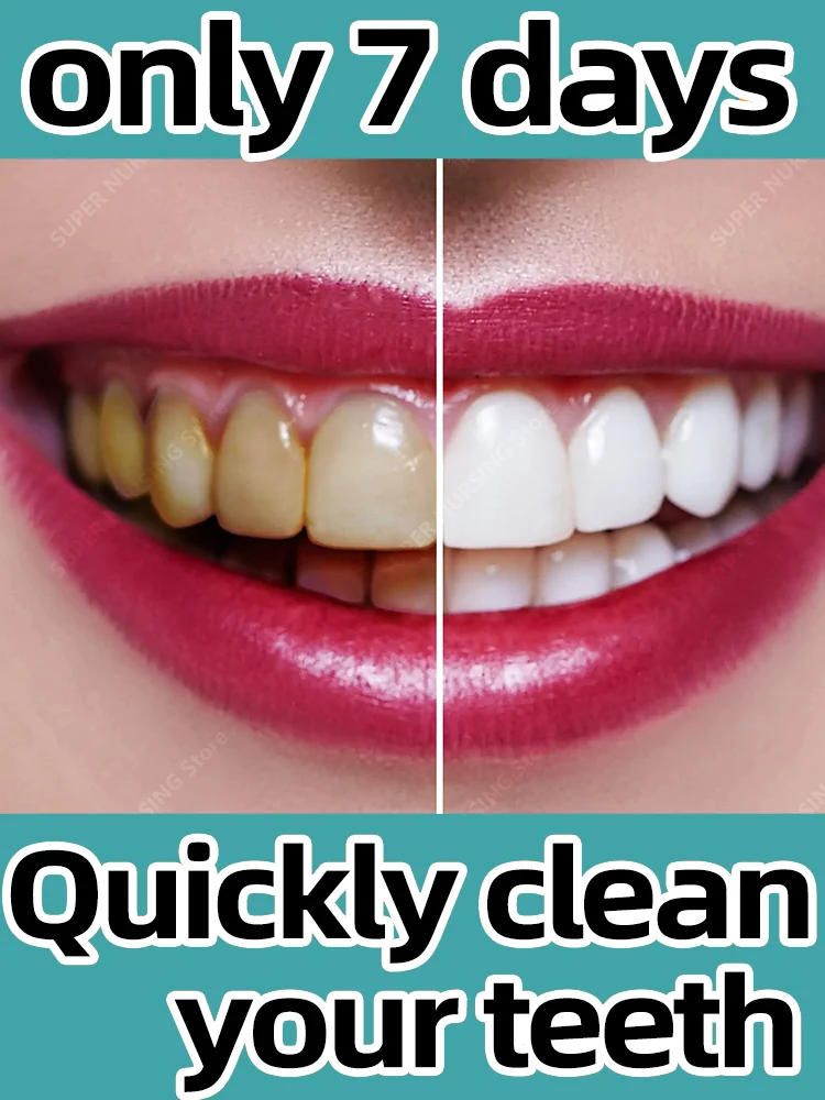 

Teeth whitening Tooth Cleaning Tartar Removal Toothpaste Mousse