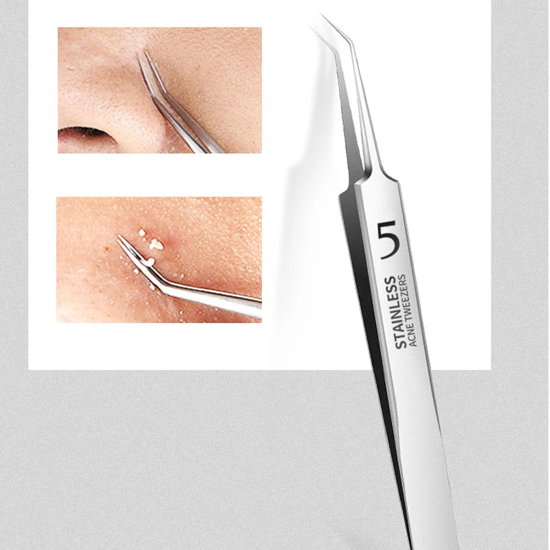 8/7/5/4 pezzi in acciaio inossidabile strumenti per la rimozione dei punti neri del viso set pinzette per punti neri bellezza rimozione dei punti neri strumento per l'ago dell'acne