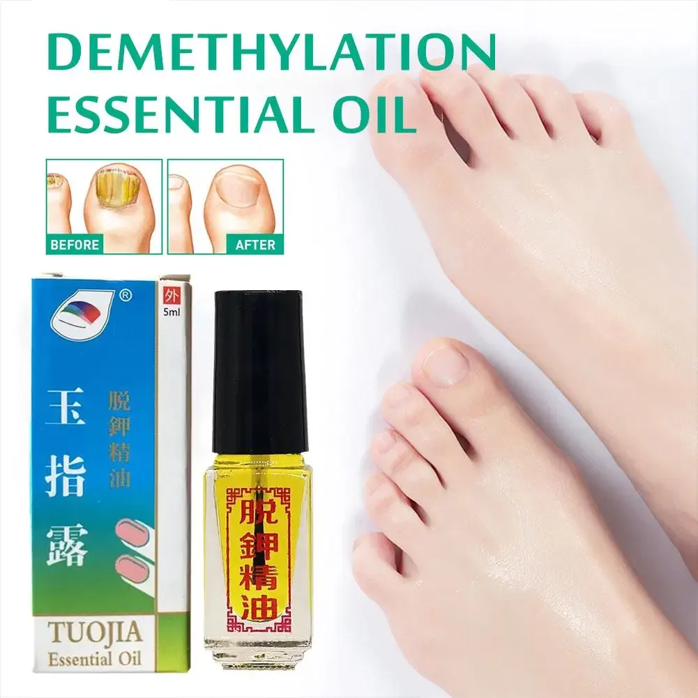 3PCS Nail Fungus Treatments Foot Care Toe Nails Fungal Removal Toe Hand 3 Effect Anti-Infection Gel Foot Onychomycosis Oil Fungu