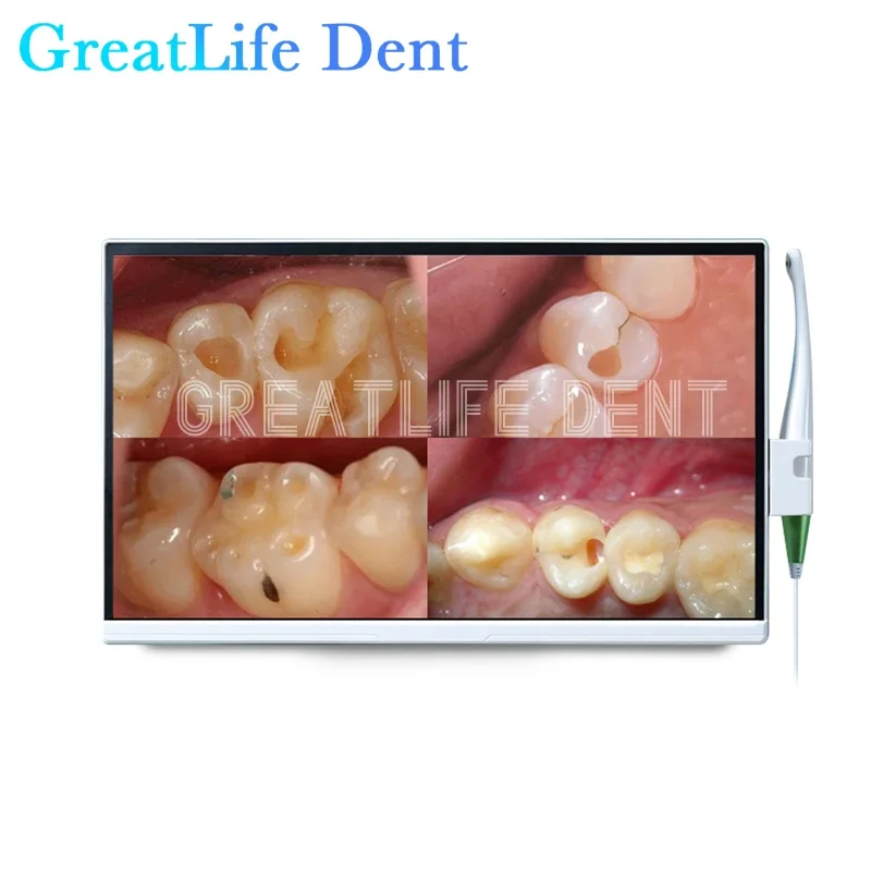 GreatLife Dent Big Screen 22inch Hd1200 10 Led Cold Light Intraoral Camera Wifi Dental Intraoral Camera Dental Intraoral Camera