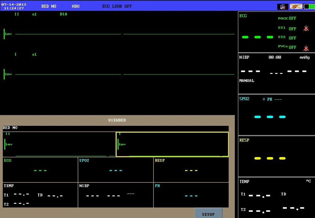 Hign Quality USB Interface Easy Operation ECG Monitor 12.1 Inch TFT Display Touch Screen Multi-Parameter Patient Monitor