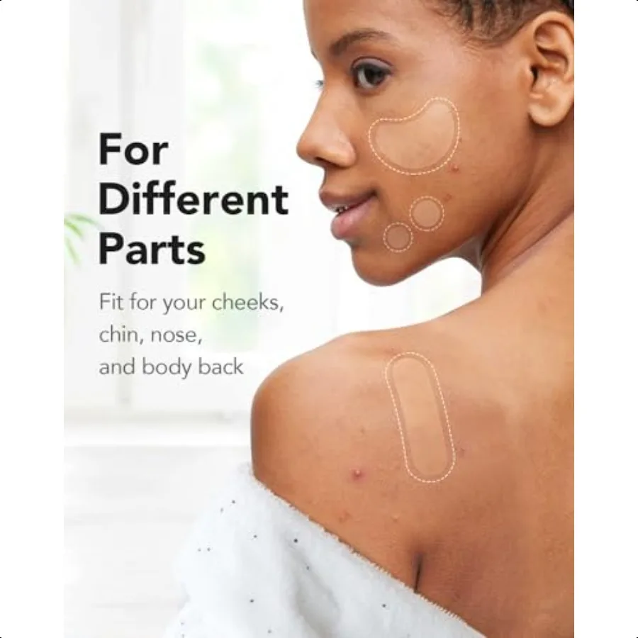 حب الشباب بثرة التصحيح 8 أحجام 140 قطعة بقع حب الشباب الغروانية المائية مع صندوق تخزين 24 XL بقع بثرة للوجه الذقن الأنف 4 أشكال Z #4