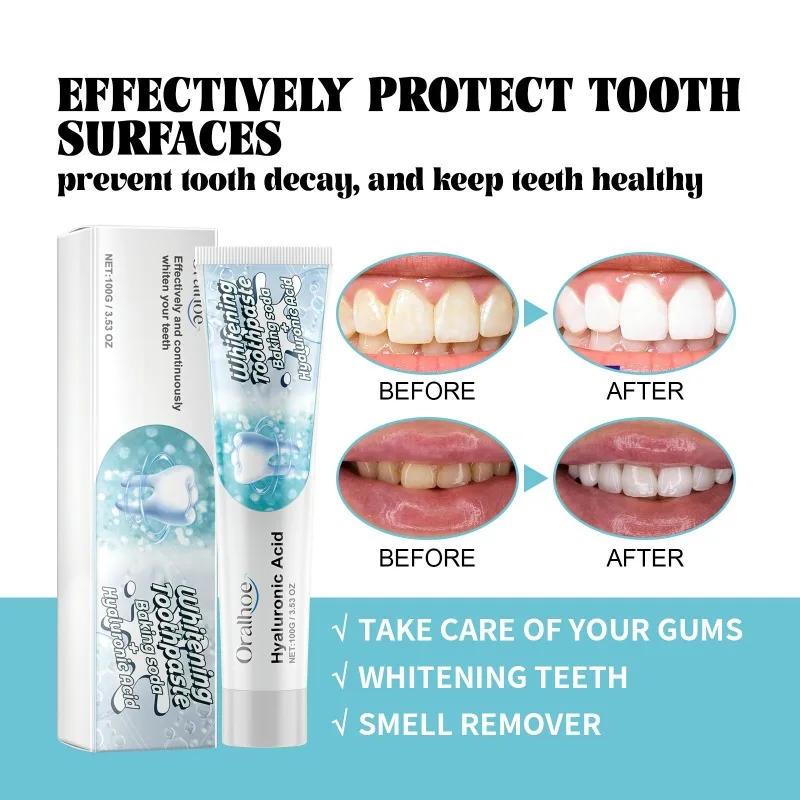 Bleaching Toothpaste Remove Yellow Stain Relieve Swollen Gum Freshen Breath Prevent Teeth Decay Periodontitis Whiten Tooth Paste