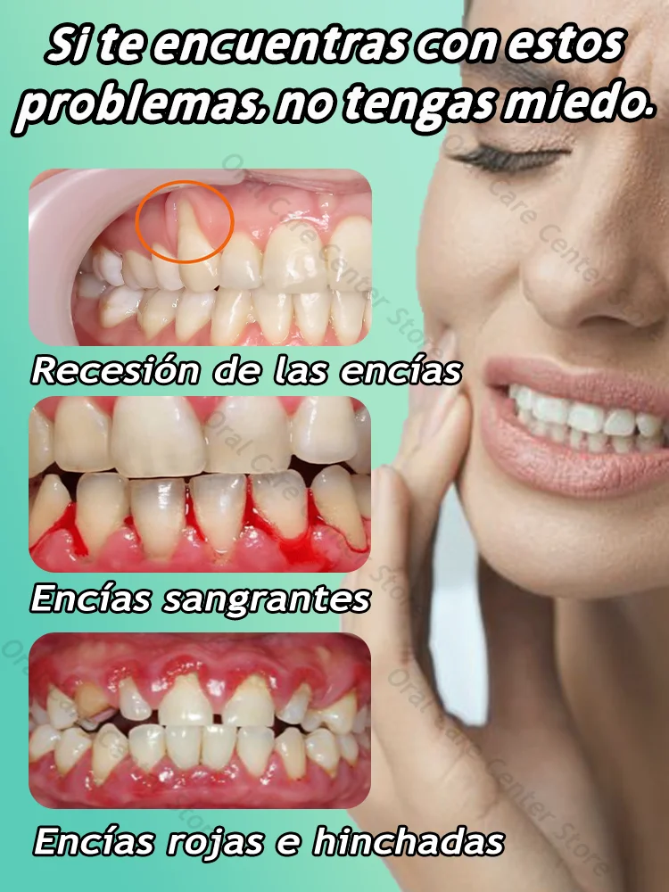 Proteja a saúde das gengivas, alivia rapidamente a dor de dente, repara gengivas danificadas e elimina o sangramento das gengivas