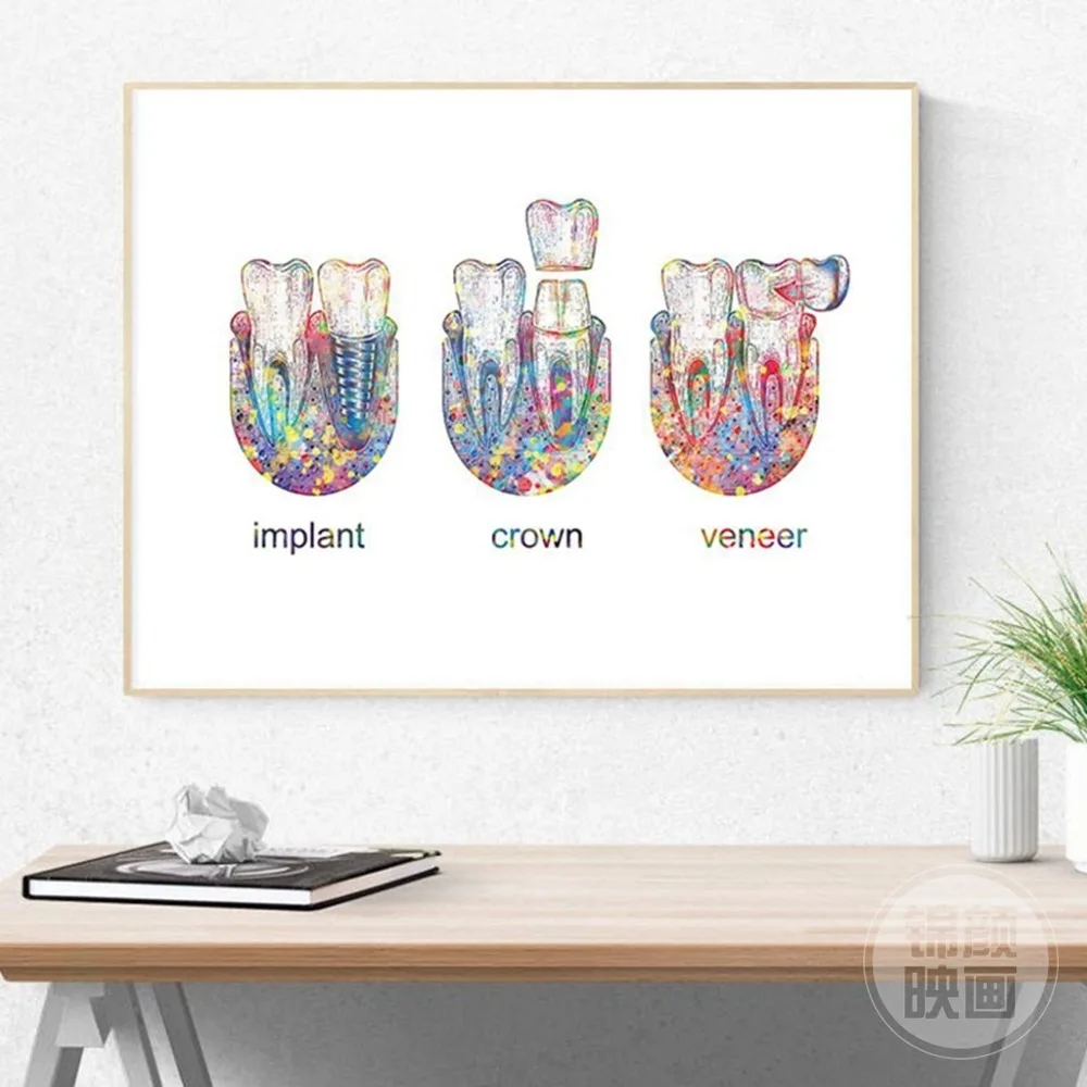 Tooth Implant Oral Clinic Medical Anatomy Posters Pictures Canvas Wall Art Home Decor Paintings for Living Room Decoration