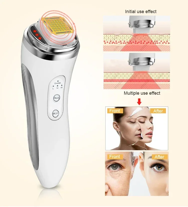 RF Radio Frequency Face Lifting Device Dot Matrix Beauty Massager Home Wrinkle Remover Skin Tightening Facial Massage Machine