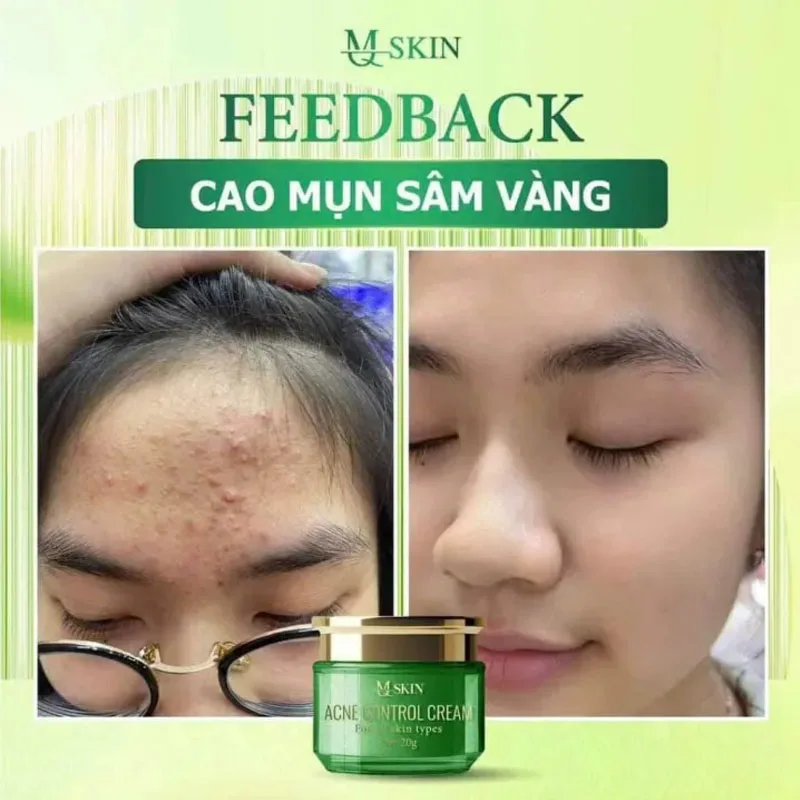 Mq Skin Kem Serum D… - image