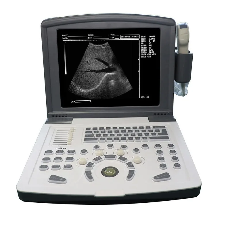 

Portable Full Digital 3D Veterinary Ultrasound Scanner Equipment Top Veterinary Instrument for Animals Animal Care and Supplies