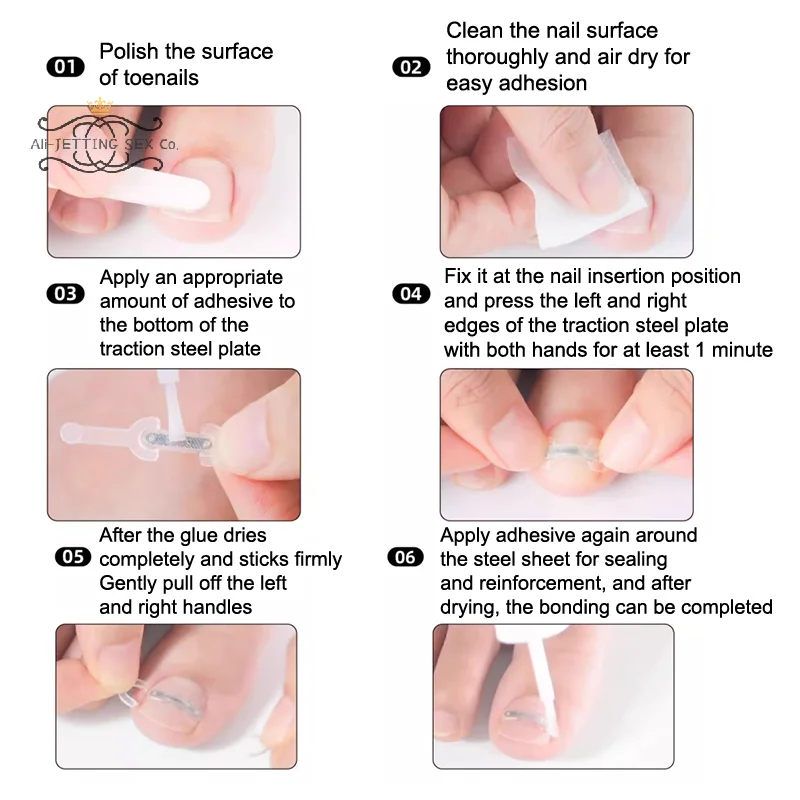 نام أظافر تصحيح نام تو علاج الأظافر رقعة مرنة ملصق استقامة كليب هدفين باديكير أداة العناية بالأظافر