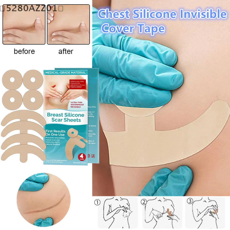 Reusable Silicon Gel Invisible Stickers Circular Arc Chest Invisible Concealer Scar Repair Patch Tattoo Flaw Conceal Tape〔HMA58〕