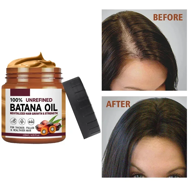 Organic 100% Batana Oil For Hair Growth For Treating Hair Loss Anti-Breakage Hair Strengthens Roots Hair Care For Women 120ML