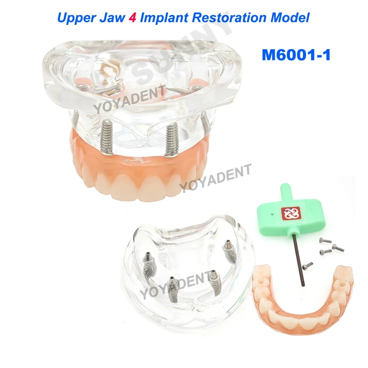 Dental Teeth Model simulation Transparent Upper Jaw 4/6 Lower Jaw 4 Implant Restoration Dentist Teaching Studying Demo