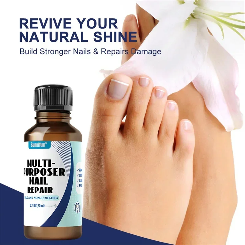 Fungal Nail Tratamento Soro, Foot Care Essence, Fungus Removal Repair Gel, Paroníquia Anti Infecção e Onicomicose