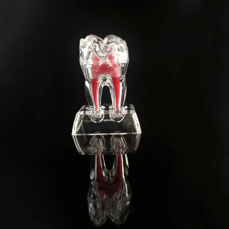 Modèle anatomique dentaire Transparent lumineux détachable, décomposition à un seul dent, ornements de clinique de dentisterie, 4 dents 70mm