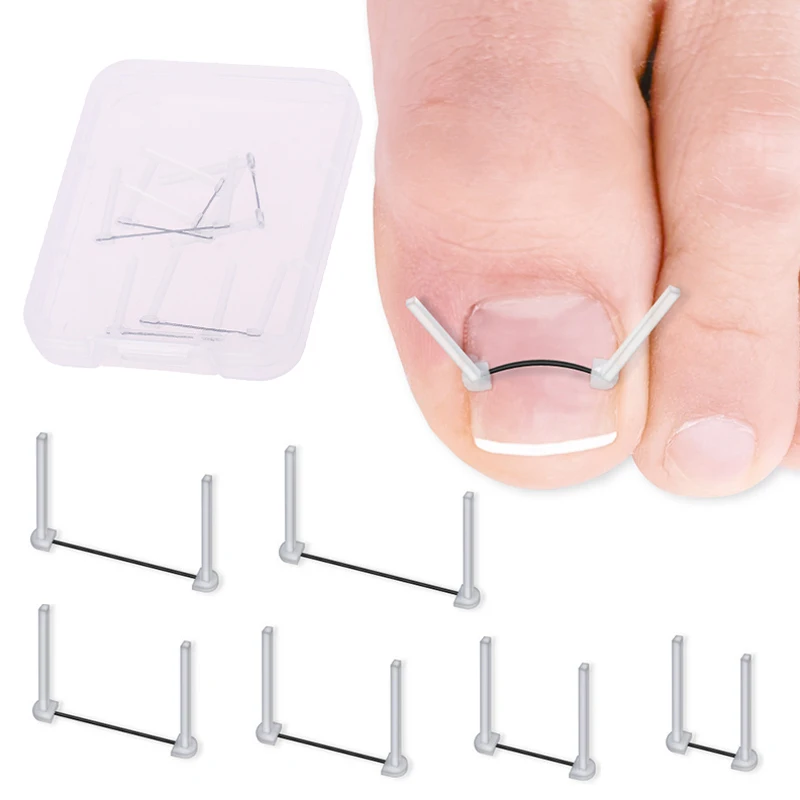 Outils de traitement professionnel pour les soins des pieds, fil de ration des ongles incarnés, récupération de gélatine, pédicure, lissage, Parker