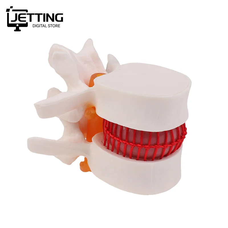 ✍ تشريح الإنسان الهيكل العظمي العمود الفقري قطني القرص فتق نموذج للتدريس الدماغ الجمجمة صدمة اللوازم المدرسية أداة طبية