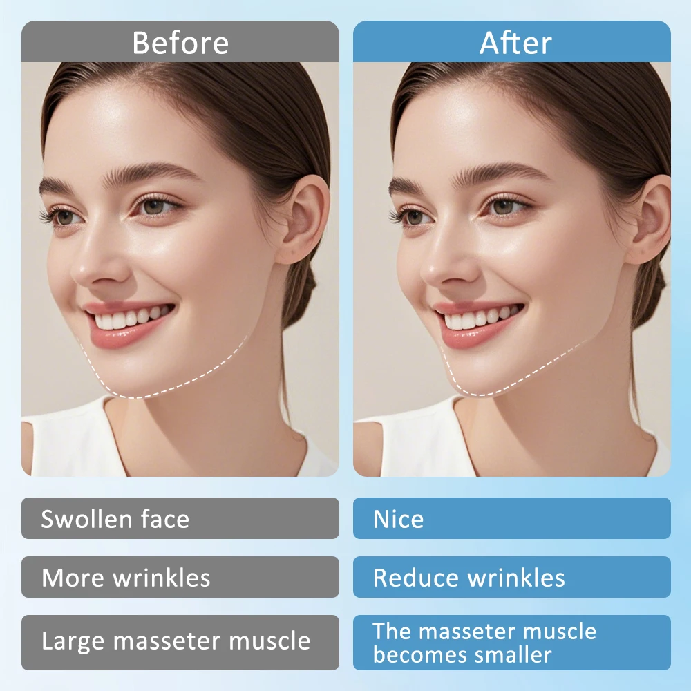 電気 V フェイスフェイスリフト装置 LED 光子療法微電流肌引き締め二重あごリムーバー EMS 顔痩身マッサージャー