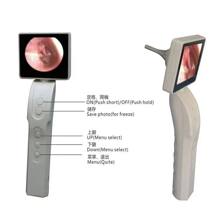 Portable Digital Video Otoscope Camera Video Scope Steel Ce Otoscope Prices Medical Led Light Source Lance Electricity 2 Years