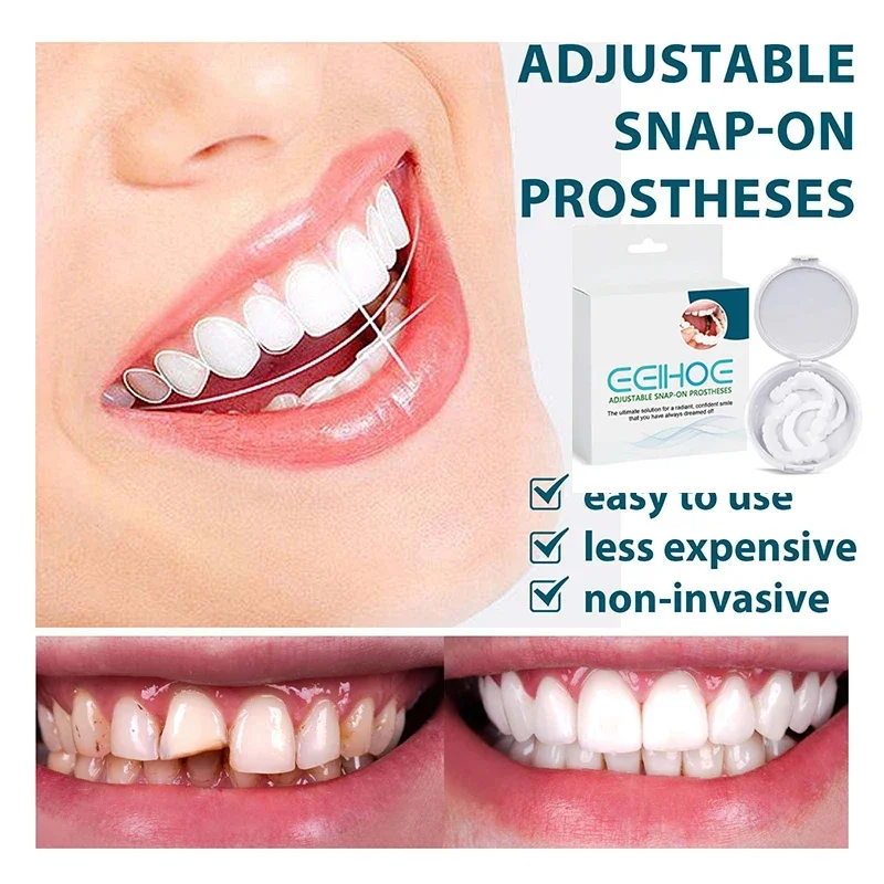 

Sdatter Adjustable Denture Teeth Set Instant Smiling Veneer Denture Whitening Tooth Natural Portable Braces Decorate Gaps Betwee