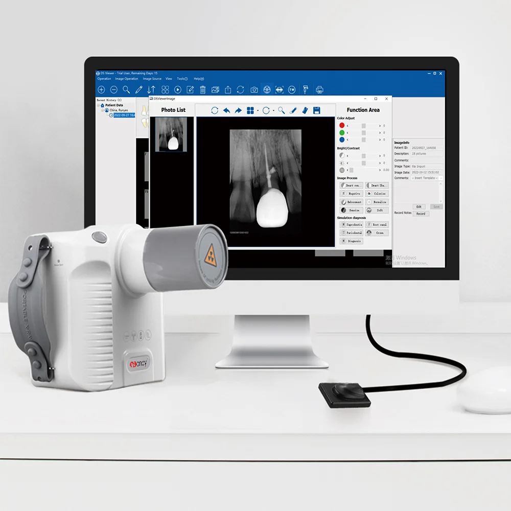 Greatlife Portable Dental X Ray Camera Wireless Rvg Image Sensor System Original Handy X-ray Machine for Dentistry Clinic