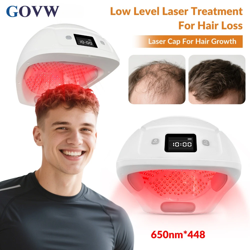 

Лазерный шлем GOVW 650 нм для роста волос, 448 диодов, беспроводной, LLLT, холодный лазер, физиотерапия, полное покрытие кожи головы от выпадения волос