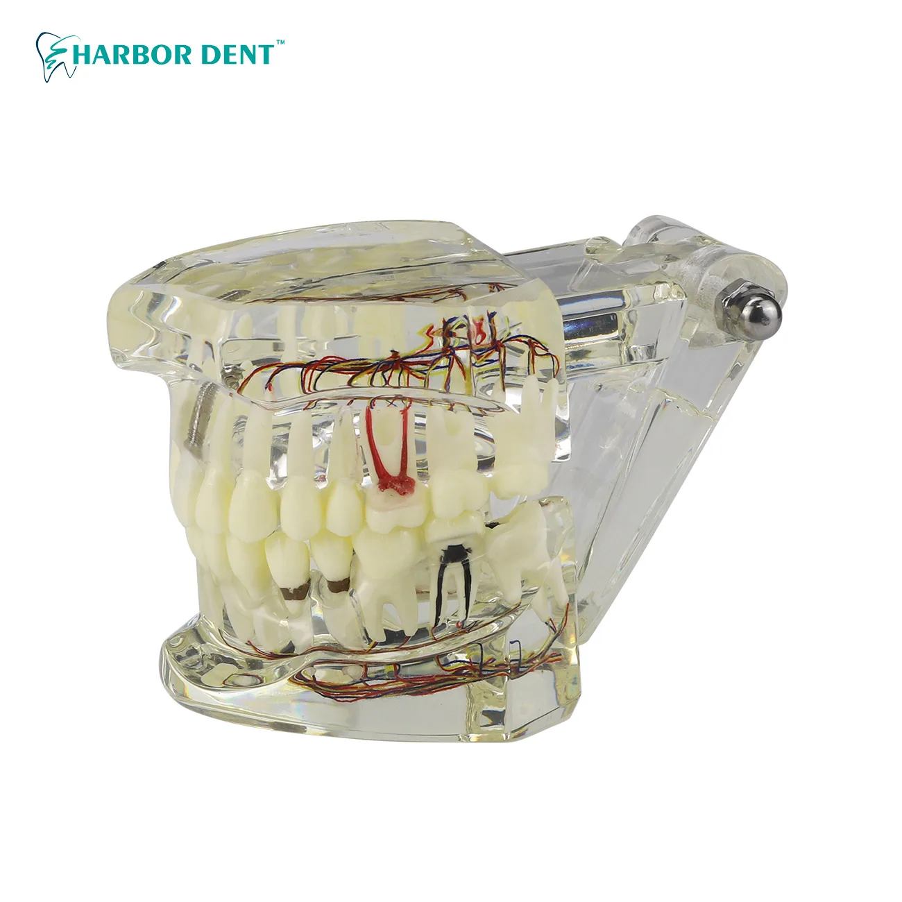 Dental Orthodontic Teeth Model With Braces Archwire Gum Tooth Resin Dentistry Materials For Studying Teaching Patient Education