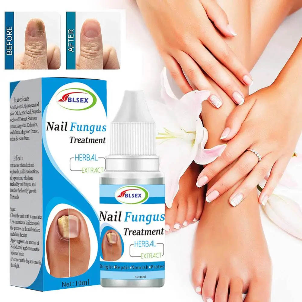 Fungus Nails Treatment for Fingernails Toenails Repair Onychomycosis Paronychia Anti Infection Toe Nail Fungal Removal Liqu A4B1