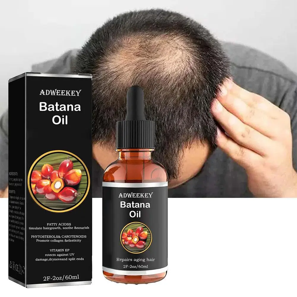 Natural Batana Fast Growth Oil Set, Tratamento Capilar, Essência Reparadora de Raiz do Cabelo, Hidratar, Mais Espessa, 60ml