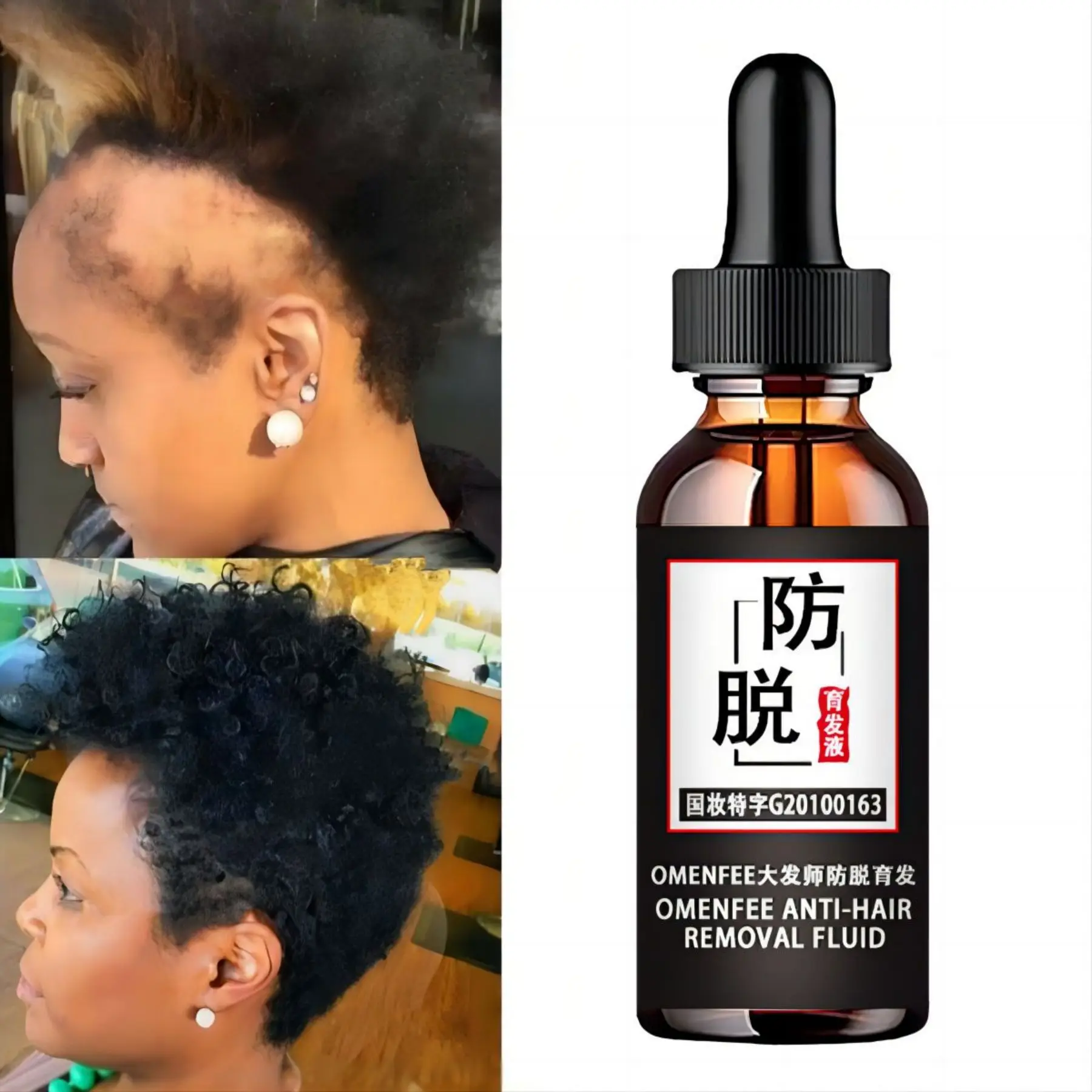 Fast Wild Growth Hair Serum Oil Treatment for Hair Loss Natural Essence for Men Women EXTREME REPAIR For Bald Spots