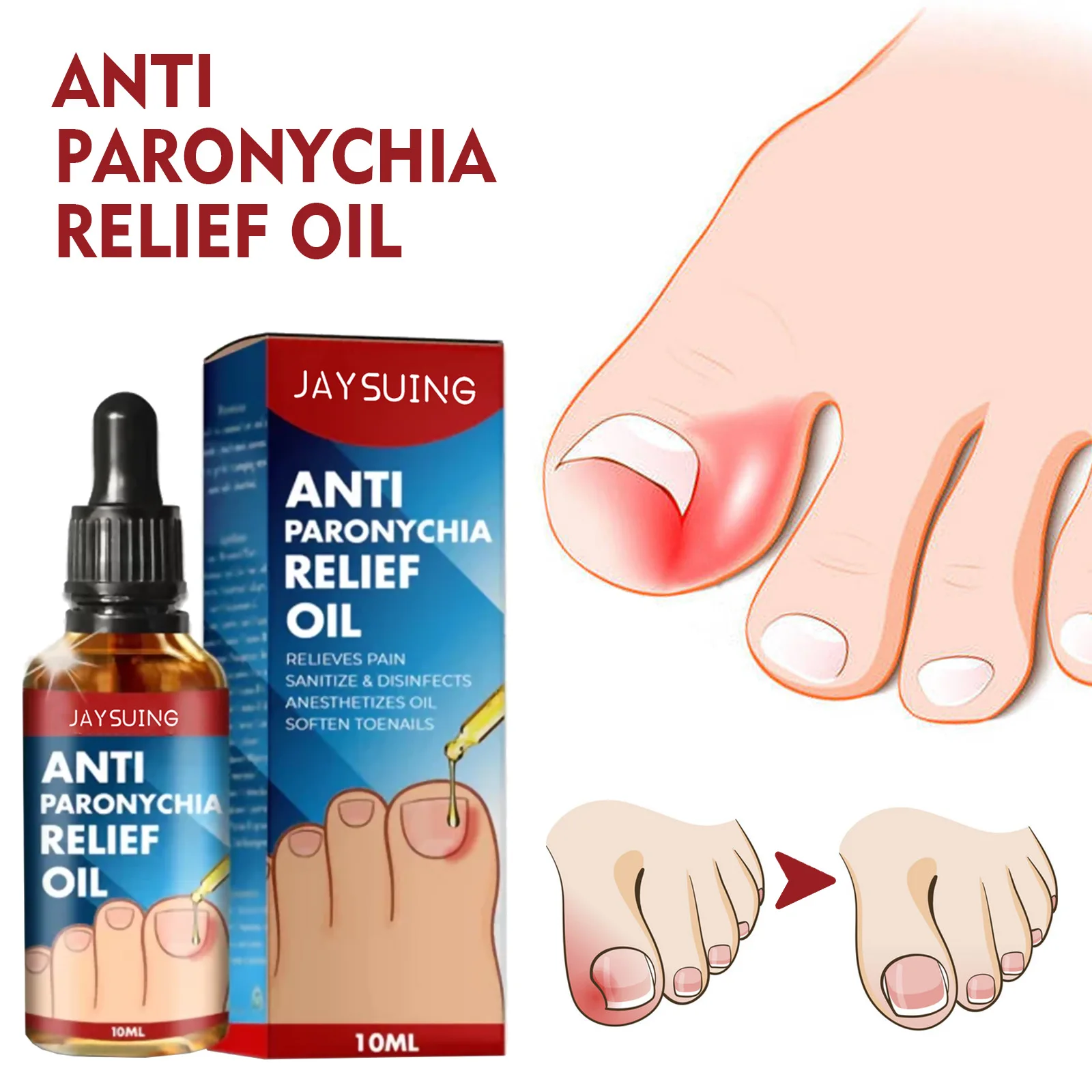 

Anti nail inflammation relief oil for repairing embedded nails thickened soft nails shiny nails gray nails nail groove care oil