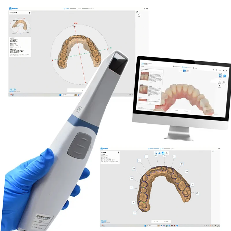 Original Dental Digital Oral Scanner 3DS Intraoral Scanner System  for Dental Implant Orthodontic Teeth Model