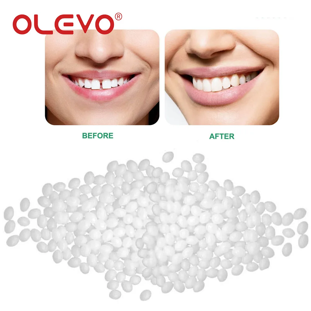 OLEVO-Materiales de llenado de dientes dentales, cuentas de pegamento de reparación temporal de dientes rotos faltantes, relleno de dentadura moldeable falsa