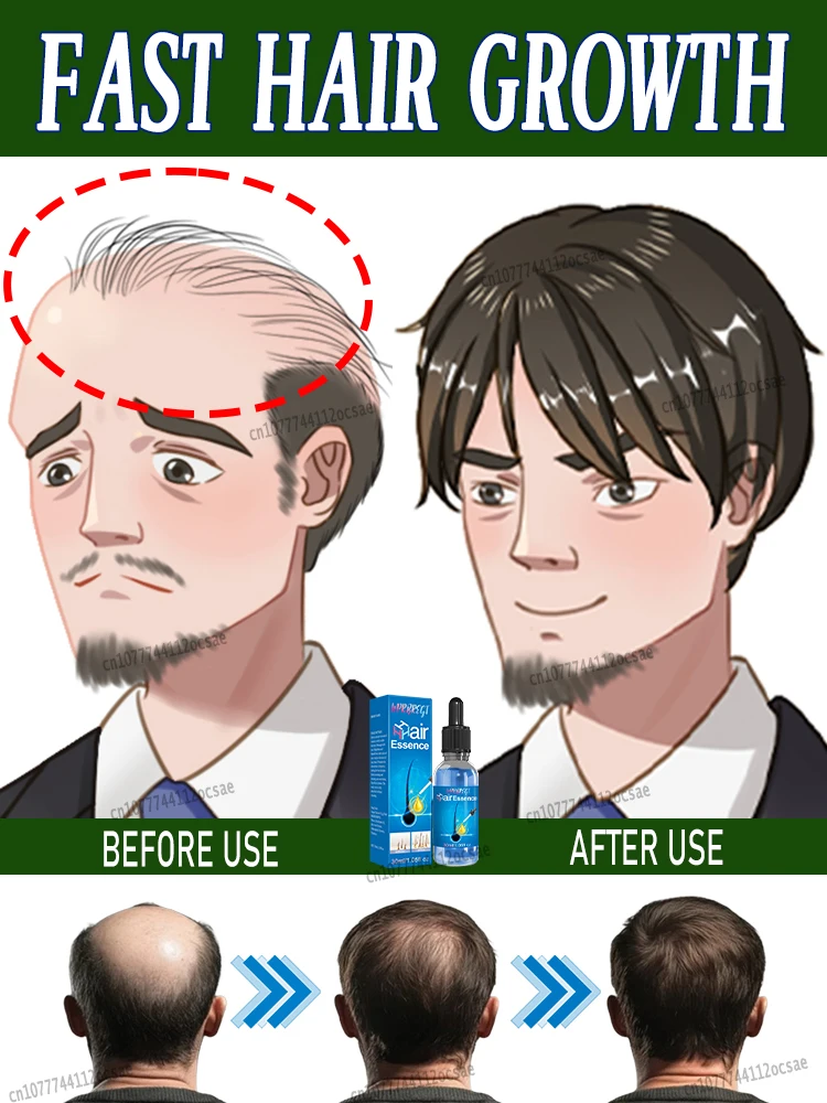 

If you are troubled by hair problems, Little Blue Bottle Hair Growth Essence can help you improve baldness