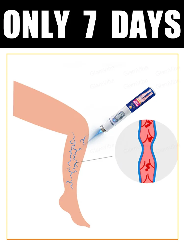 

No more tight veins in 7 days
