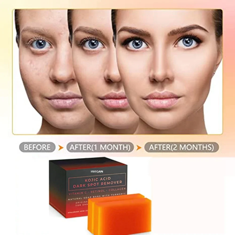 

VALITIC Kojic Acid Soap Whitening Soap Remove Black Facial Soap Handmade Bleaching Acid Glycerin With Vitamin C Deep Cleaning