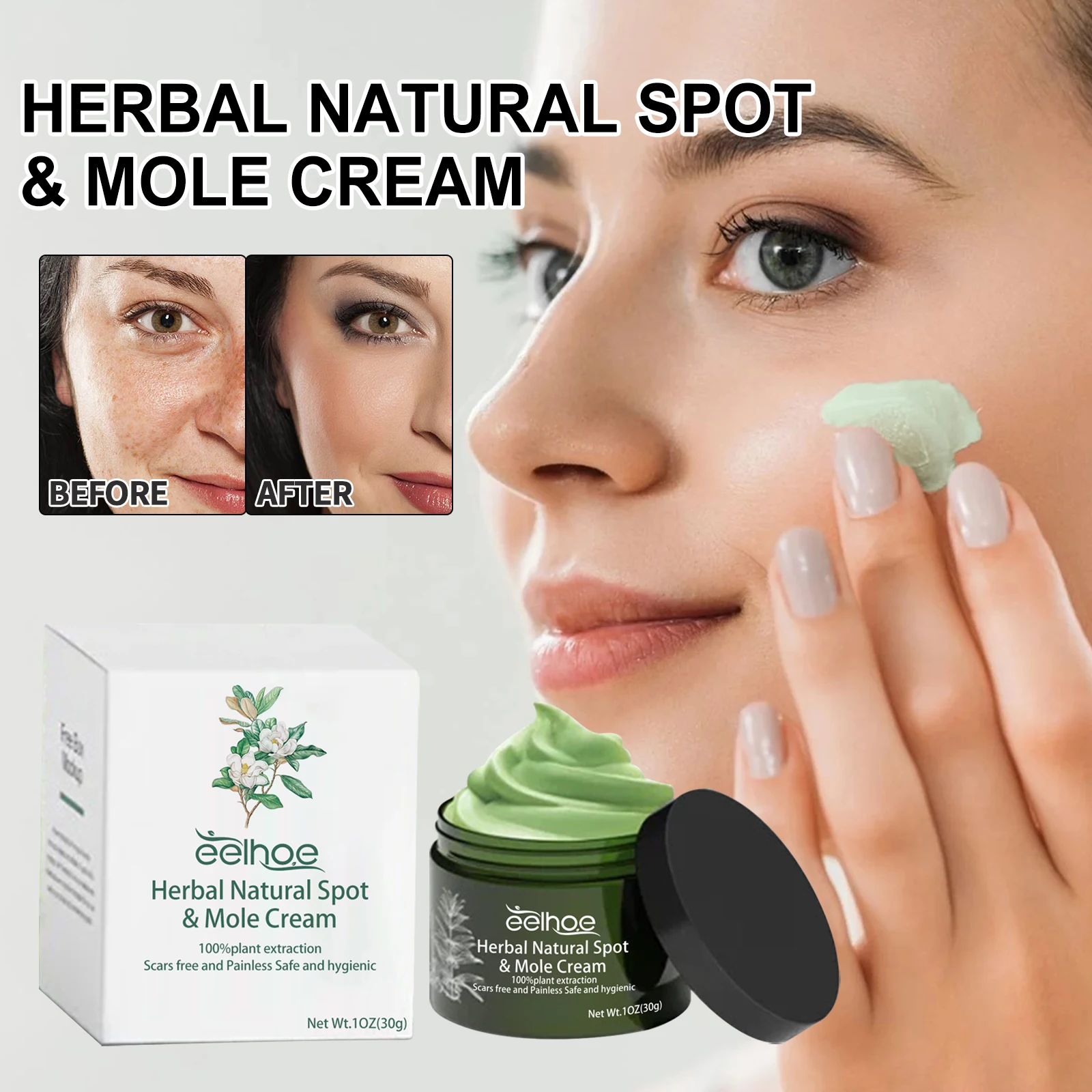 EELHOE Face Spot Remover Cream Moisturizing Brightening Skin Melasma Lightening Acne Marks Treatment Soothing Facial Skin Care