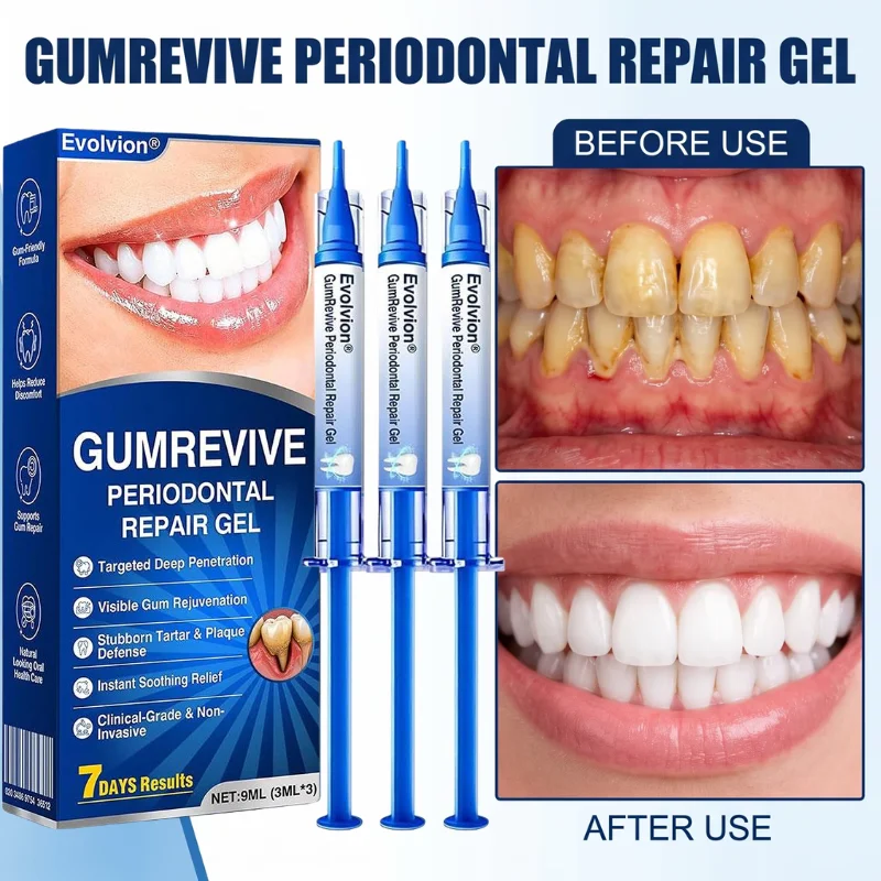 Teeth Whitening Singapore - 3 ml x 3 Gel Soin
