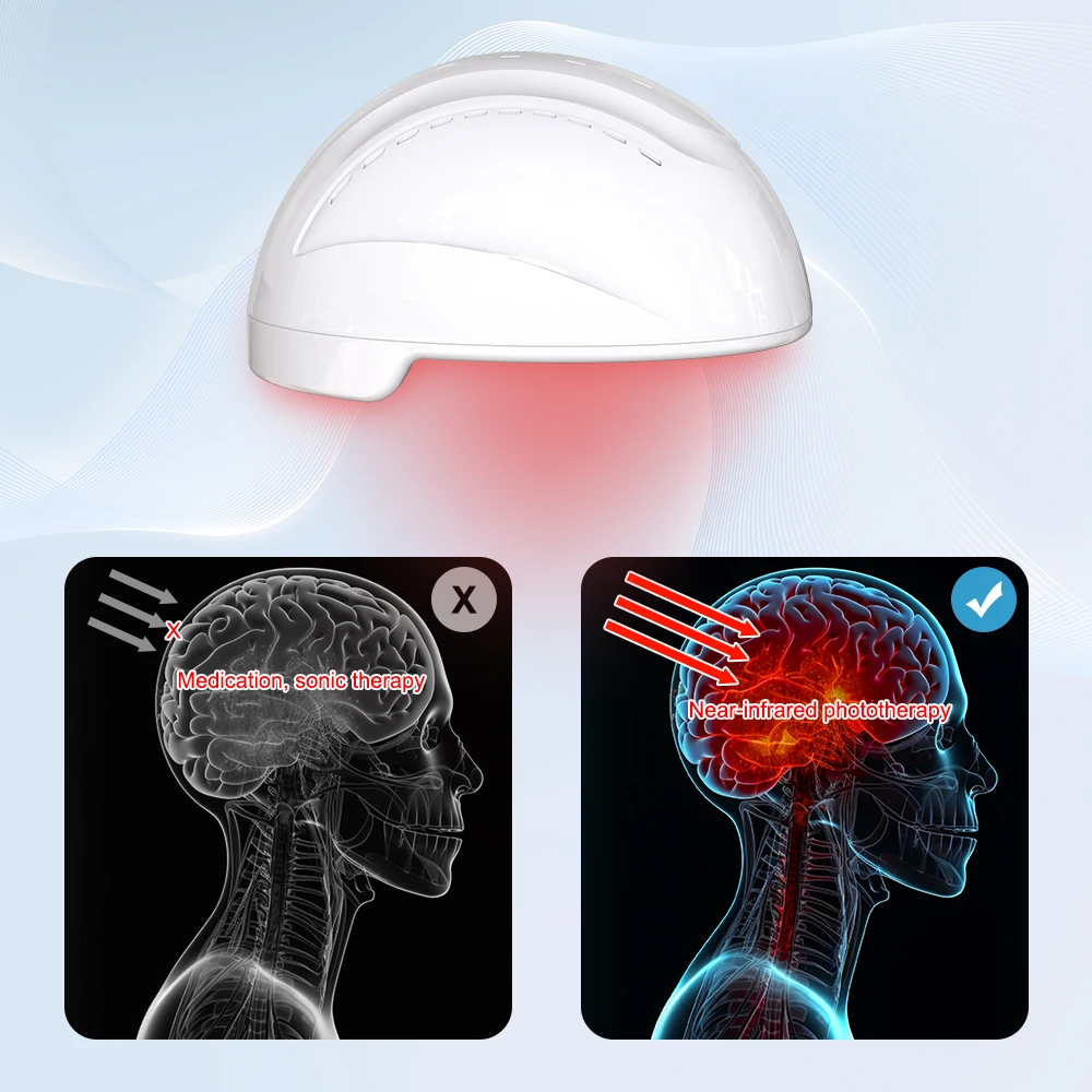 Near Infrared light Therapy for Dementia Parkinson Alzheimer Disease Photobiomodulation Helmet