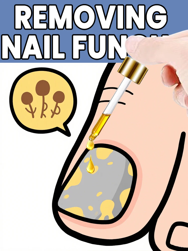 

Hot selling powerful combination: laser + nail microbiome essence, a complete toenail treatment system