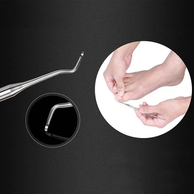 Uñas encarnadas: herramienta profesional de pedicura podológica - imagen 2
