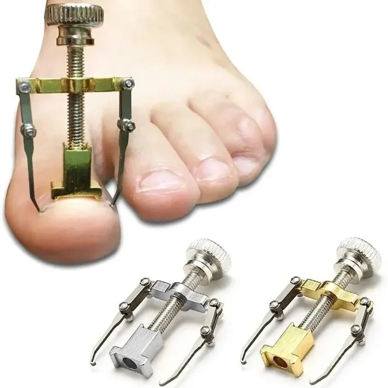 

For Treatment of Toe and Toe Care with Toe Fixator Correction of Paronychia with Toe Nail Correction Bracket