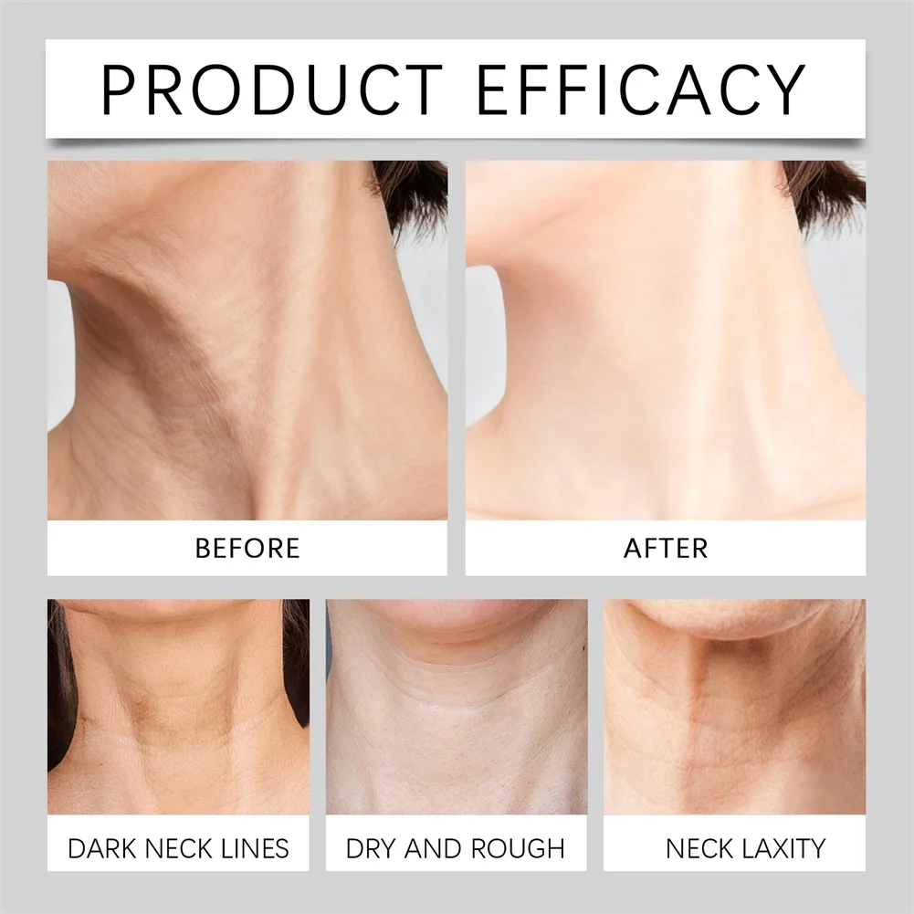 Overnight Neck Firming Pads For Women Visibly Reduces Neck Wrinkles Fast Long Hours Of Office Work (Tech Neck)