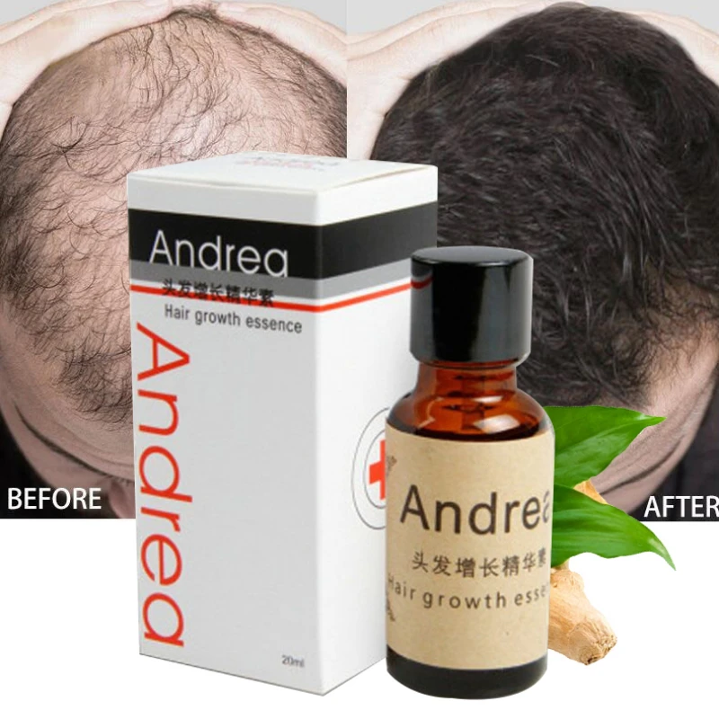 نمو الشعر السريع زيت الزنجبيل جوهر النباتات الطبيعية تنمو الشعر منشط تزايد الشامبو لا فقدان العناية بالشعر أدوات التجميل #1