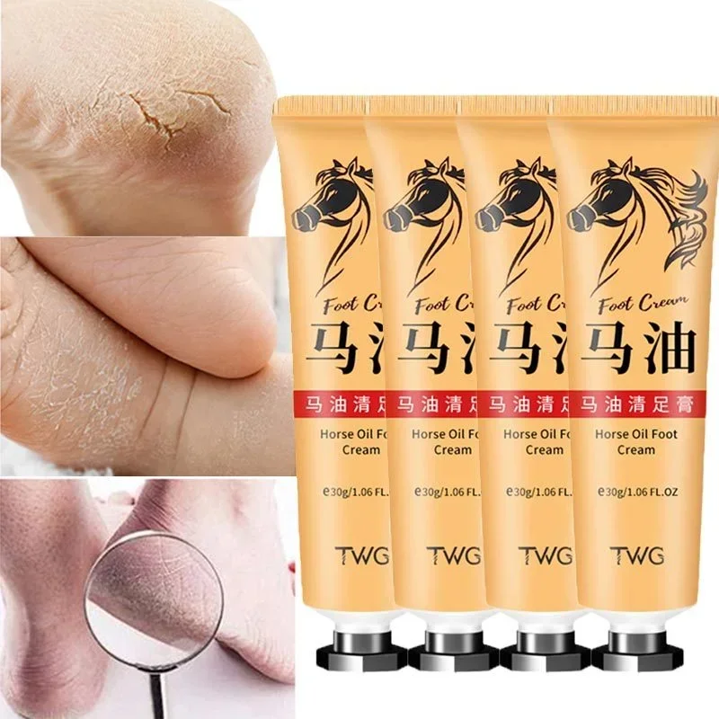 Horse Oil Hand And Foot Repair Cream Skin Moisturizing Foot Skin Care Repair Cream Removal Dead Feet Treatment For Leg