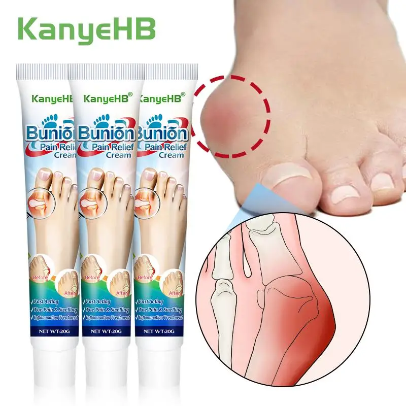 

1/3/5Pcs Anti Bunion Cream Bunion Corrector Toe Separator Orthopedic Straightener Foot Pain Swelling Relieve Ointment Foot Care